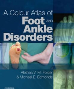 A Colour Atlas of Foot and Ankle Disorders 1st edition by Alethea VM Foster BA PGCE DPodM MChS SRCh , Michael E Edmonds MD FRCP  ISBN 0443102074 978-0443102073