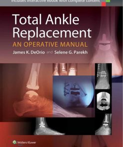 Total Ankle Replacement An Operative Manual