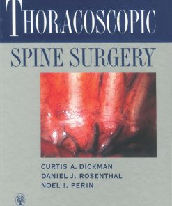 Thoracoscopic Spine Surgery