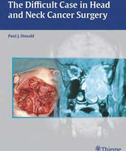 The Difficult Case in Head and Neck Cancer Surgery 1st edition by Paul Donald ISBN B0CMYW4HHS‎ 978-1638533115