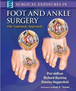 Surgical Exposures in Foot and Ankle Surgery The Anatomic Approach 1st edition by Piet deBoer, Richard Buckley, Stanley Hoppenfeld, Hugh Thomas ISBN 1451144504 978-1451144505