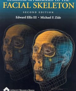 Surgical Approaches To The Facial Skeleton 2nd Edition by Edward Ellis, Michael Zide ISBN 0781754996 9780781754996