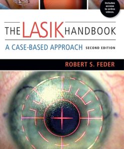 The LASIK Handbook A Case Based Approach 2nd Edition by Robert Feder ISBN B00C1IBJWC 978-1469830162