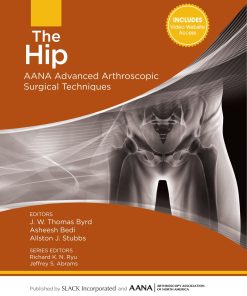 The Hip AANA Advanced Arthroscopic Surgical Techniques 1st edition by Thomas Byrd, Asheesh Bedi, Allston Stubbs ISBN 1630910006 9781630910006