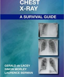 The Chest X Ray A Survival Guide 1st edition by Gerald de Lacey, Simon Morley, Laurence Berman ISBN 0702051074 9780702051074