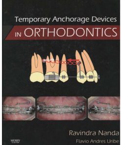Temporary Anchorage Devices in Orthodontics 1st edition by Ravindra Nanda ISBN 0323048072 	9780323048071