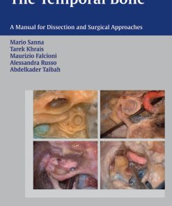The Temporal Bone A Manual for Disection and Surgical Approaches 1st edition by Mario Sanna, Tarek Khrais, Maurizio Falcioni, Alessandra Russo, Abdelkader Taibah ISBN 3132579583 9783132579583