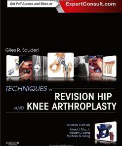 Techniques in Revision Hip and Knee Arthroplasty 1st edition by Giles Scuderi ISBN 1455723683 978-1455723683