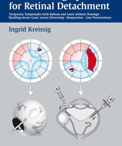 A Practical Guide to Minimal Surgery for Retinal Detachment Volume 2 1st edition by Ingrid Kreissig ISBN 313257872X 9783132578722
