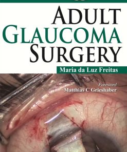 Adult Glaucoma Surgery