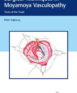 Surgical Techniques in Moyamoya Vasculopathy Tricks of the Trade Plus Online at MedOne 1st edition by Peter Vajkoczy ISBN 3131450614 978-3131450616