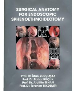 surgical anatomy for endoscopic sphenoethmoidectomy