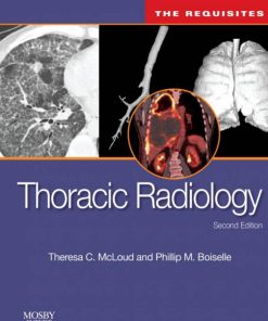 Thoracic Radiology The Requisites Second Edition