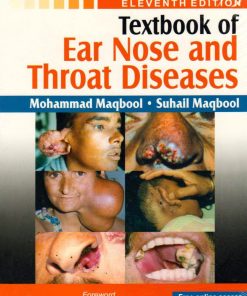 Textbook of Ear Nose and Throat Diseases 11th