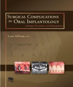 Surgical Complications in Oral Implantology Etiology Prevention and Management