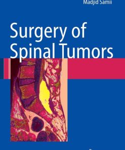 Surgery of Spinal Tumors