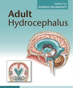 Adult Hydrocephalus Daniele Rigamonti