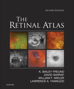 The Retinal Atlas 2nd Edition by Bailey Freund, David Sarraf, William Mieler, Lawrence Yannuzzi ISBN 0323287921 978-0323287920