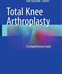 Total Knee Arthroplasty A Comprehensive Guide
