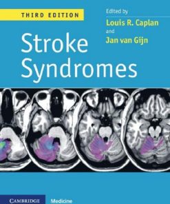 Stroke Syndromes