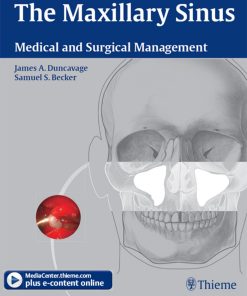 The Maxillary Sinus Medical and Surgical Management 1st Edition by James Duncavage 9781604062816 1604062819