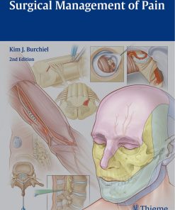 Surgical Management of Pain 2nd Edition