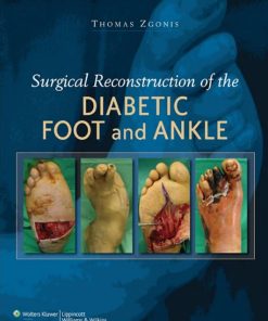 Surgical Reconstruction of the Diabetic Foot and Ankle