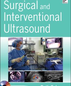 Surgical and Interventional Ultrasound Beth Schrope MD PhD FACS RDMS