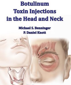 Techniques of Botulinum Toxin Injections in the Head and Neck