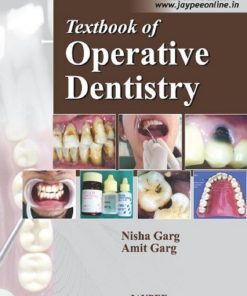 Textbook of Operative Dentistry by Nisha Garg