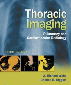 Thoracic Imaging Pulmonary and Cardiovascular Radiology