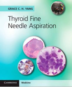 Thyroid Fine Needle Aspiration 1st Edition